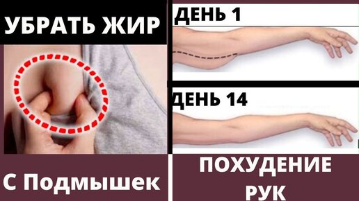 Как Убрать ЖИР С ПОДМЫШЕК ДОМА ? Очень эффективный массаж