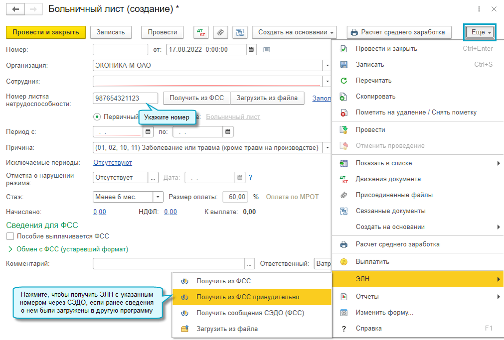 Элн выплаты. Электронный листок нетрудоспособности. Электронный больничный лист. Как выглядит лист нетрудоспособности электронный. Больничный лист в ФСС через 1 с предприятие.