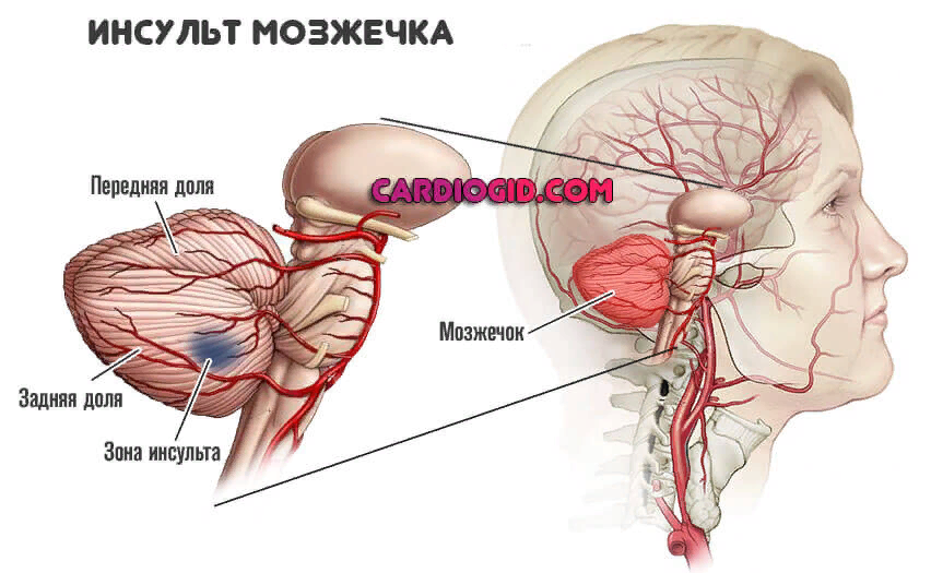 картинка с сайта кардиогид.ком