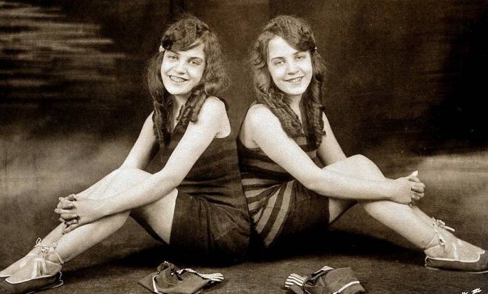 Фото: paranormal-news.ru звезды водевиля и актрисы - сиамские близняшки Дейзи и Виолетта Хилтон