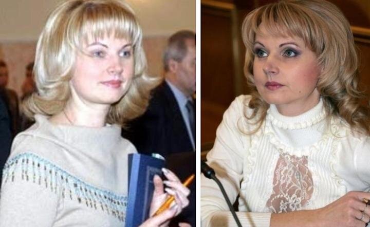 Голикова до и после пластики