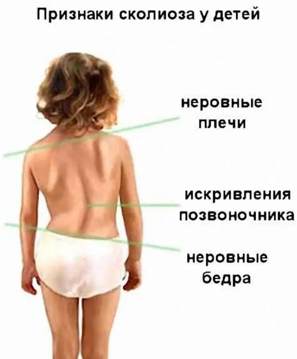 Врождённое укорочение нижней конечности у ребёнка