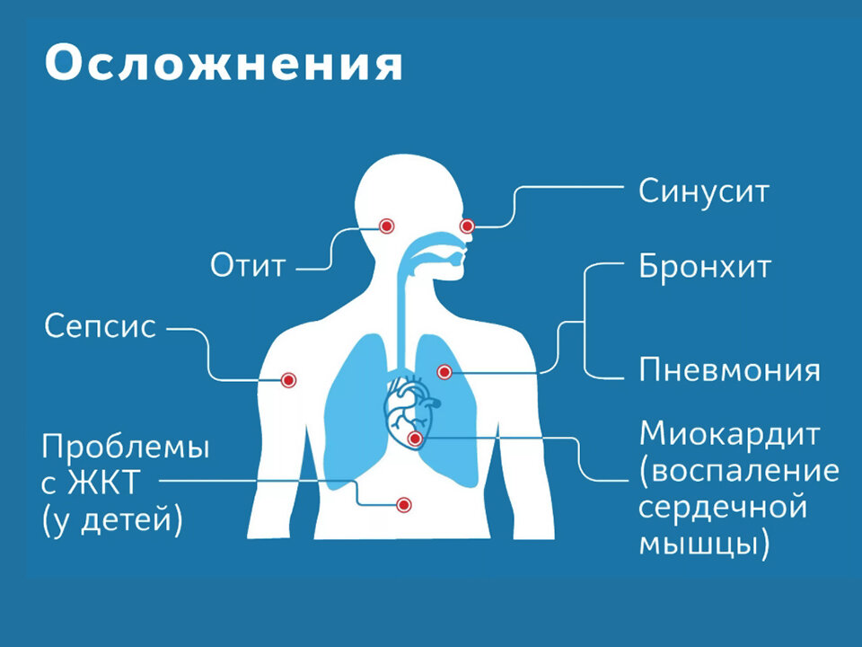 Клиническая картина коронавируса