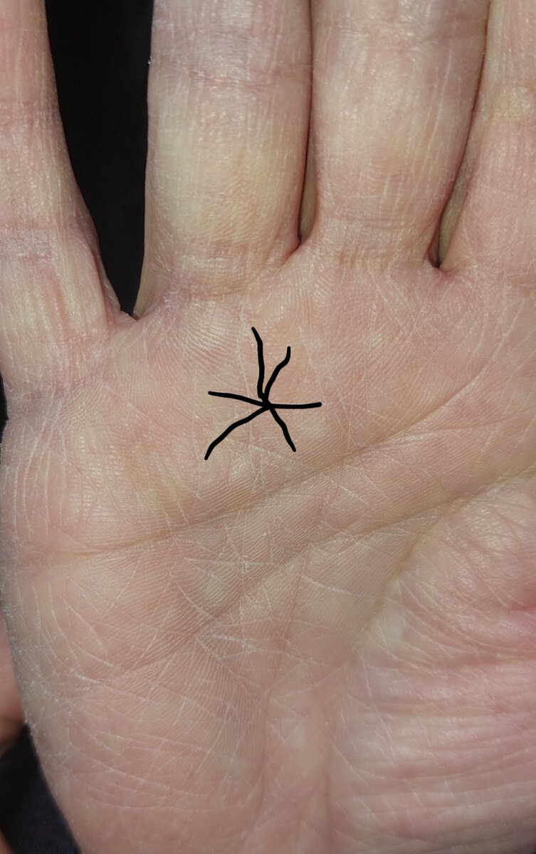 Звезда на холме Аполлона. На данном фото является  негативным знаком. У женщины тяжелая судьба. Но тем не менее она является ,, знаменитой,, личностью в определенных кругах. Является Смотрящей за бомжами и бездомными.