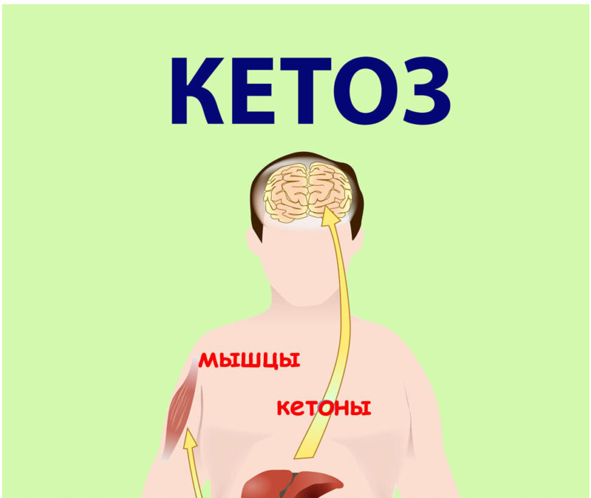 Признаки кетоза у человека