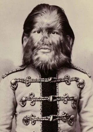 Фёдор Евтихиев - «человек-собака» (портрет 1880-х)