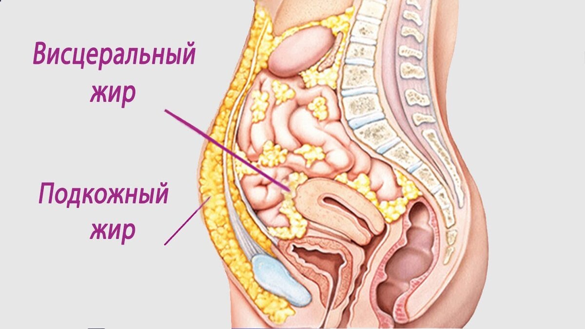 Удаление жира на боках в Москве: цена - от руб., отзывы | Клиника Beauty Trend