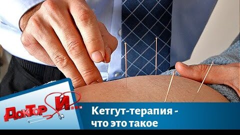 Кетгут-терапия - что это такое Доктор И