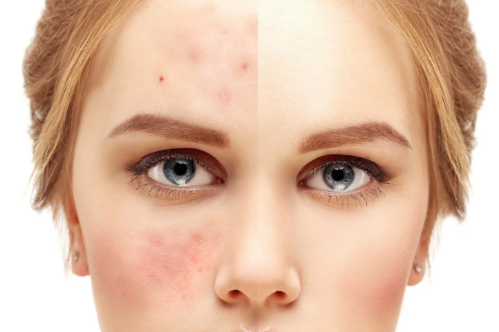 Яндекс. Картинки