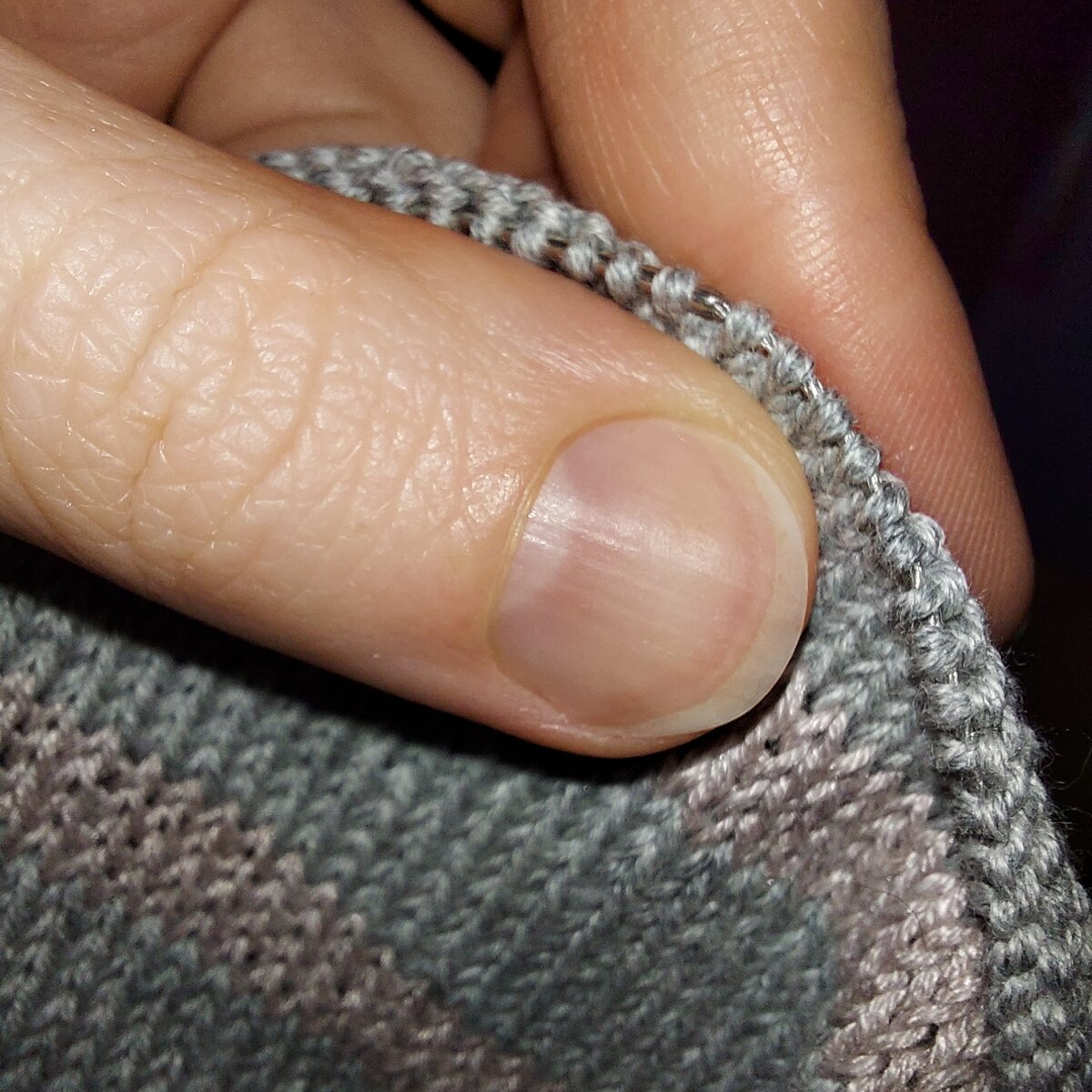 Стык спицы и "лески"