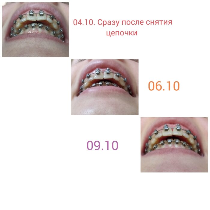 Листайте вправо, чтобы увидеть больше изображений