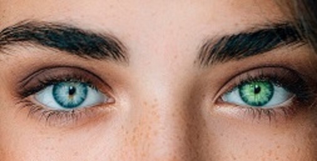 Полная гетерохромия