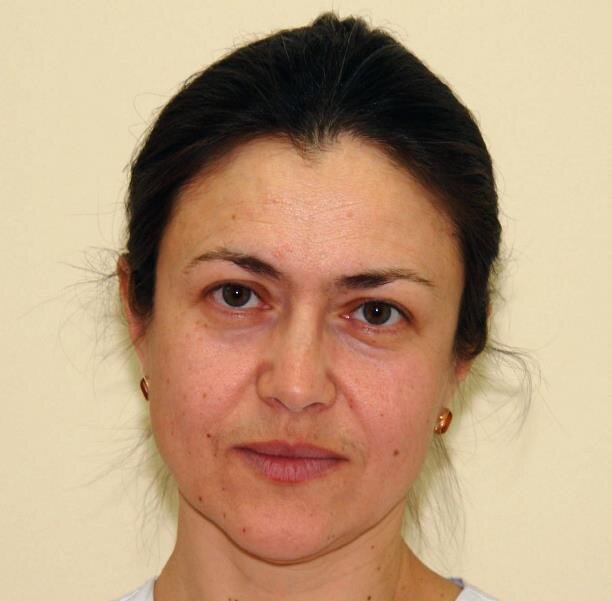 Антирейтинг: топ-5 «женских» болезней | Myslo.ru | Дзен