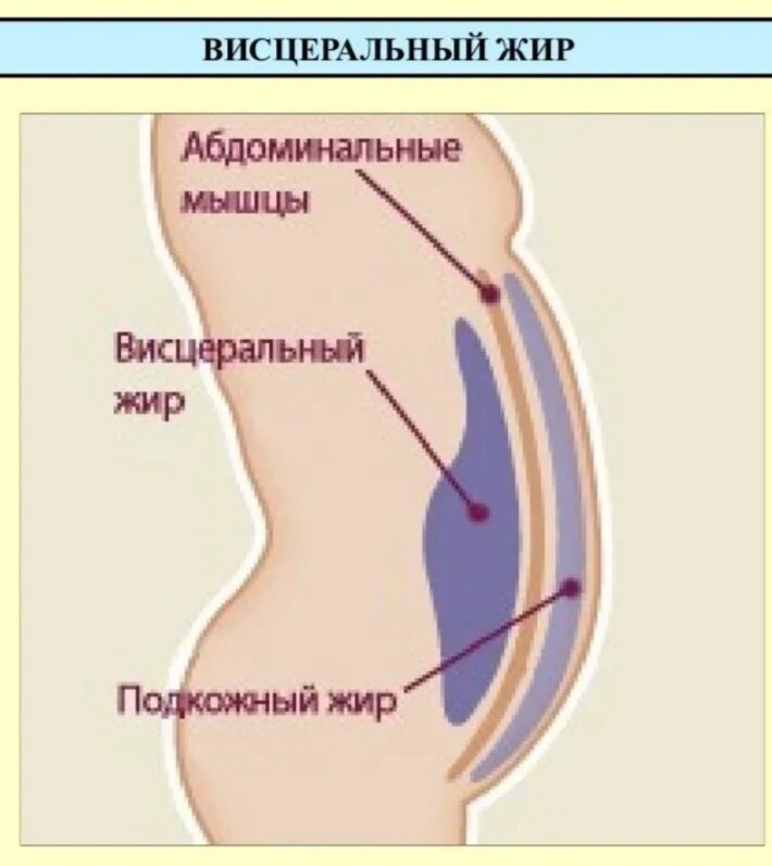 Висцеральный жир. Абдоминальный и висцеральный жир. Подкожный и висцеральный жир. Подкожный, висцеральный жир на животе.