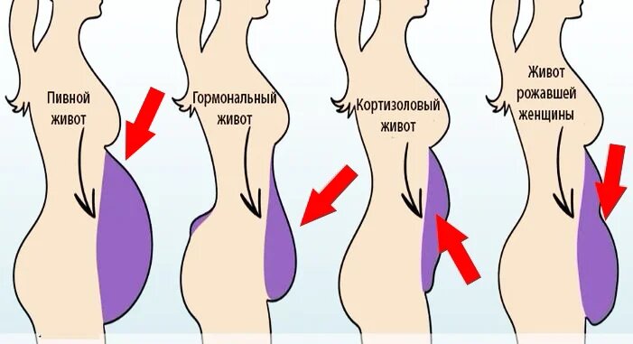 Почему у женщин живот