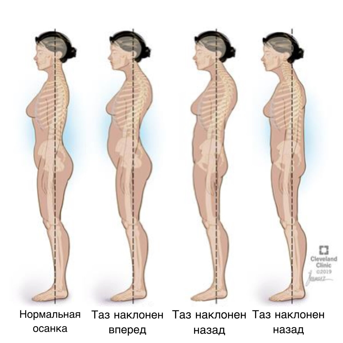 Изображения по запросу Натяжение при наклоне - страница 2