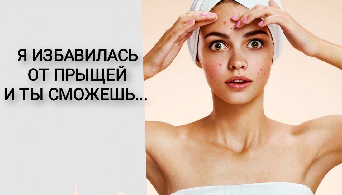 #прыщи #акне #красота #макияж #подростки #роды #дети 