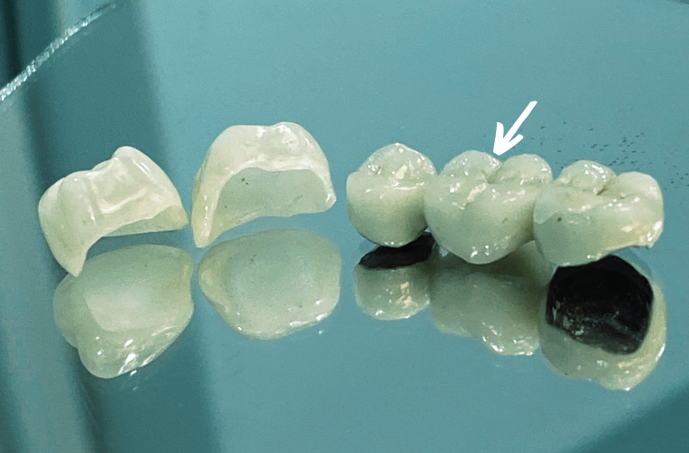 на фото стрелкой обозначен "понтик"