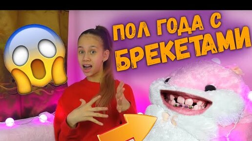 Что Такое Брекеты?! История Про мои Кривые😱 Зубы