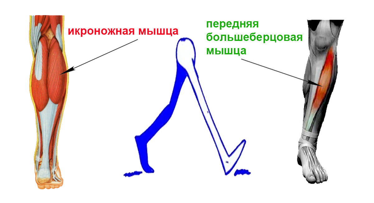 Профилактика и лечение болей в икроножных мышцах в Москве - клинике Доктор Длин