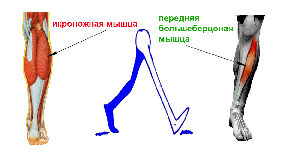 Питание и упражнения при похудении ног