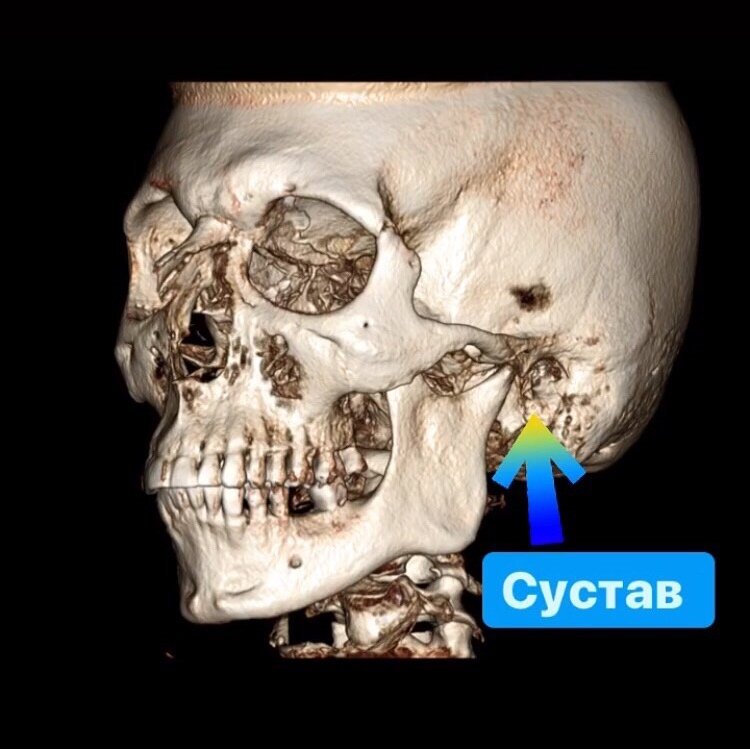 Правда, лобные пазухи для стоматолога не информативны, они полезны для ЛОРа, а вот пазухи верхней челюсти очень даже нужны, и они тоже попадают «в кадр».
