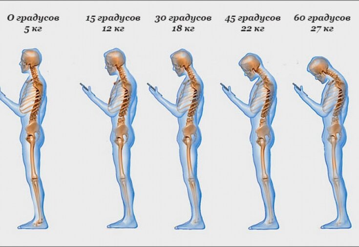 Какую нагрузку терпит ваша спина? 