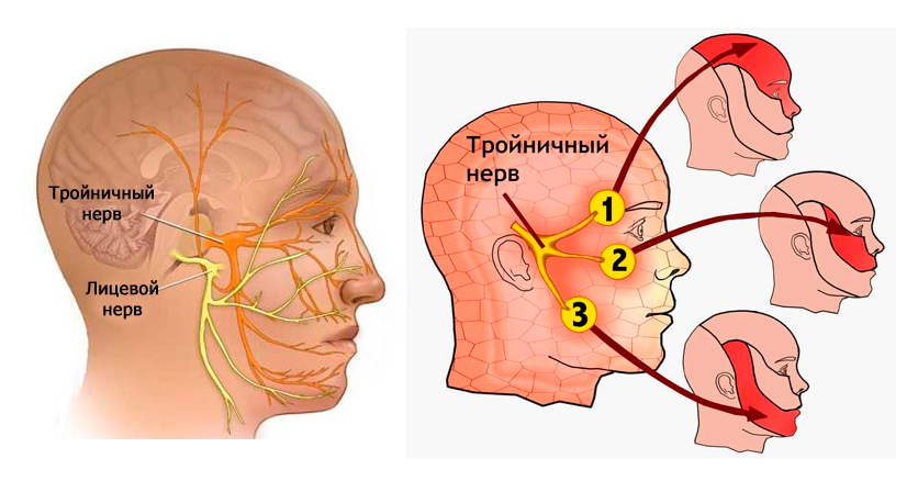 Воспаление тройничного нерва: причины, симптомы, диагностика и лечение