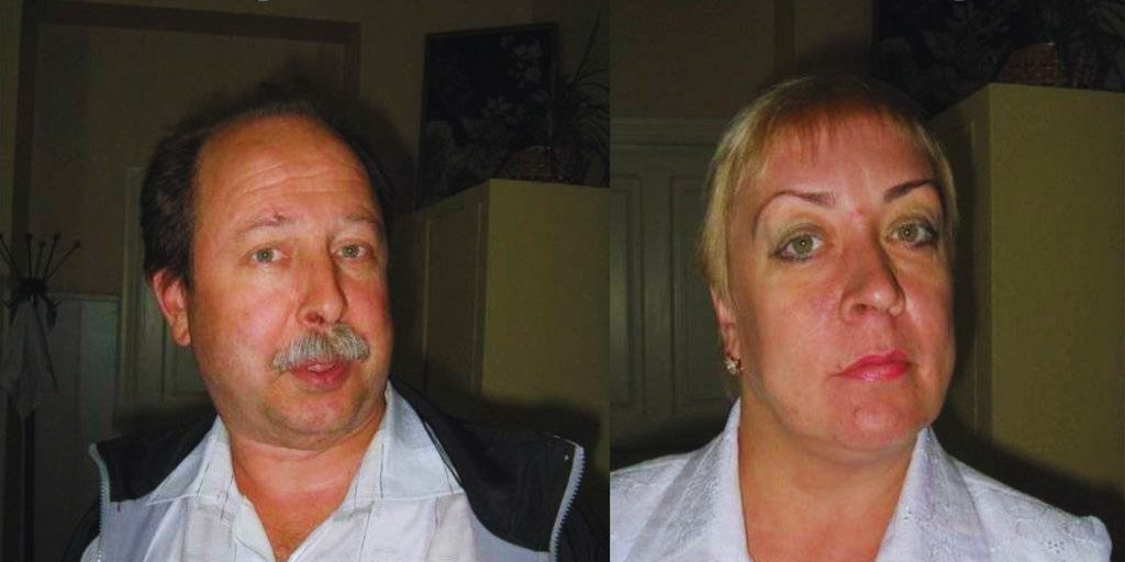 Патологические позы головы. и шеи.