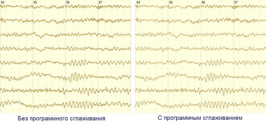 Как улучшить сосуды – рекомендации эксперта