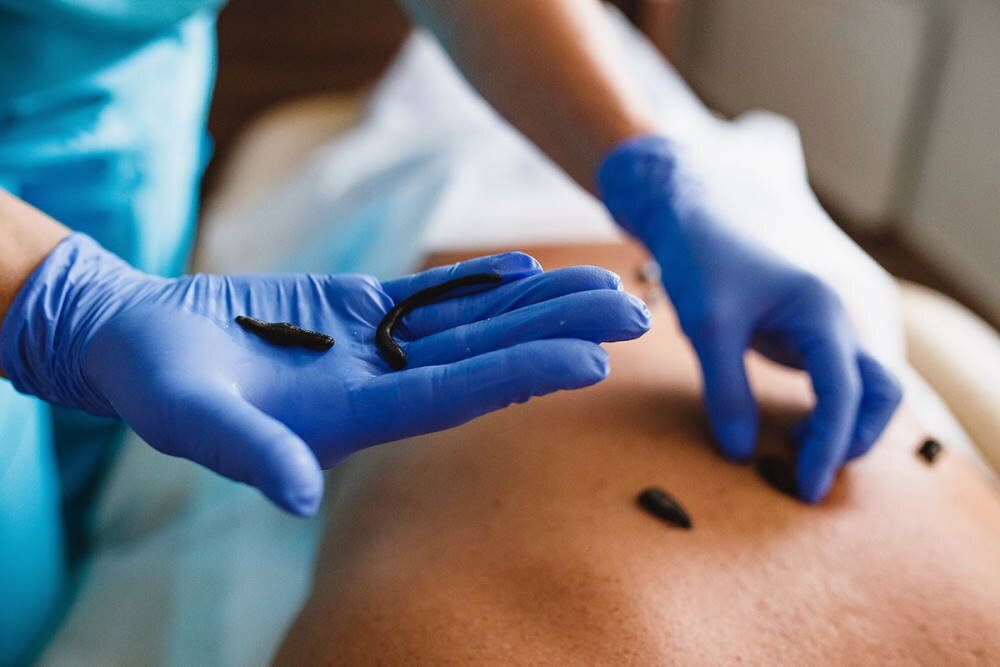 Лечение пиявками совершенно безопасно