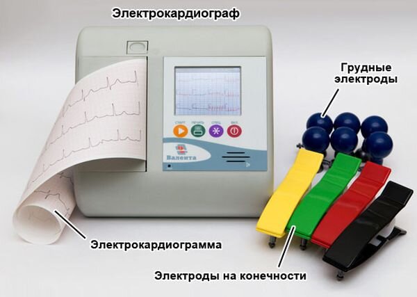 Расшифровка показателей ЭЭГ головного мозга