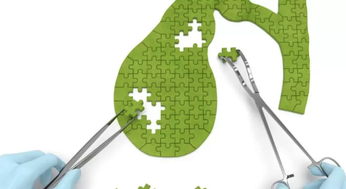 Лучше всего желчный пузырь сокращается в ответ на жирную еду, хуже всего – на белки. Фото: Flickr 
