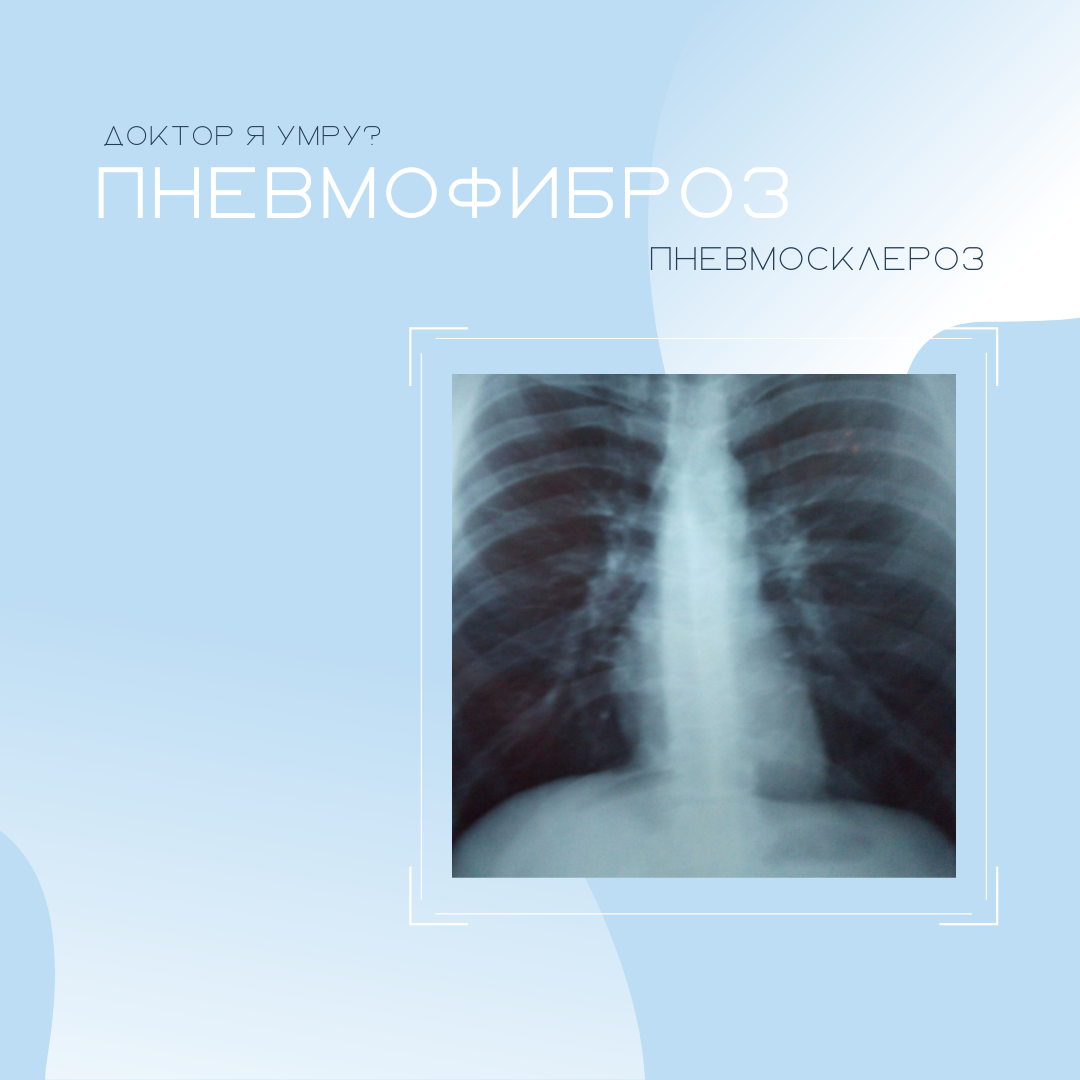 Диффузный пневмосклероз отзывы. Диффузный пневмосклероз отзывы