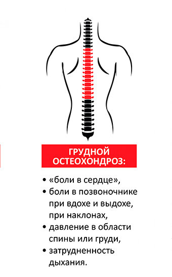 признаки остеохондроза