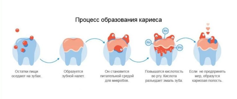 Средства профилактики кариеса