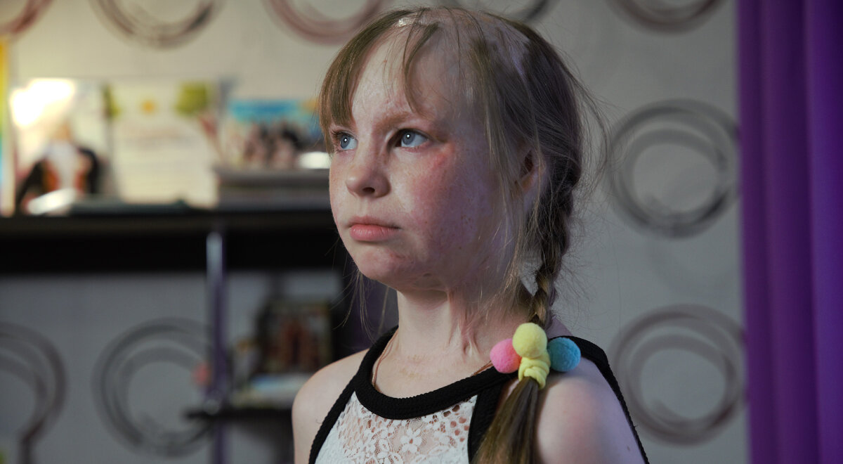 Алеся Петракова, подопечная фонда "Алёша"