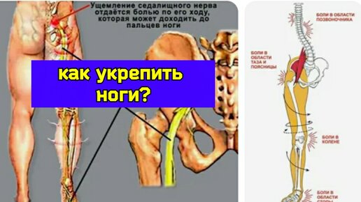 Нарушения в стопах и тазобедренных суставах. Как правильно подобрать упражнения для мышц?