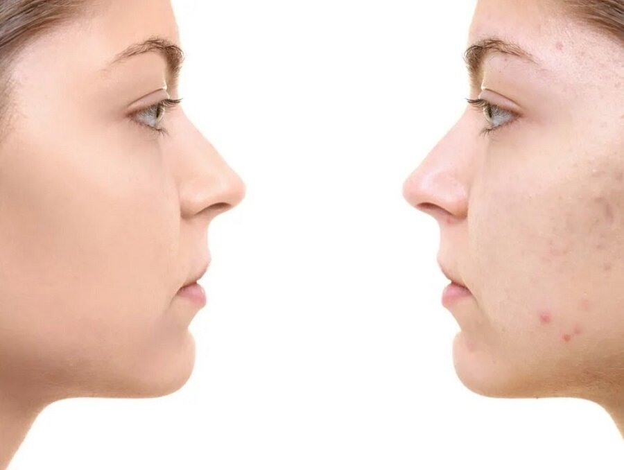    Фото: www.vichy.ru/ Pravda-nn.ru