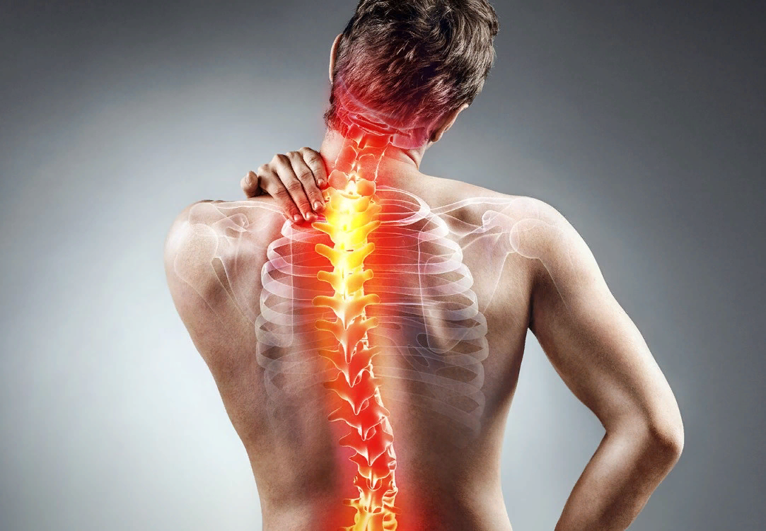 Боли при остеохондрозе
