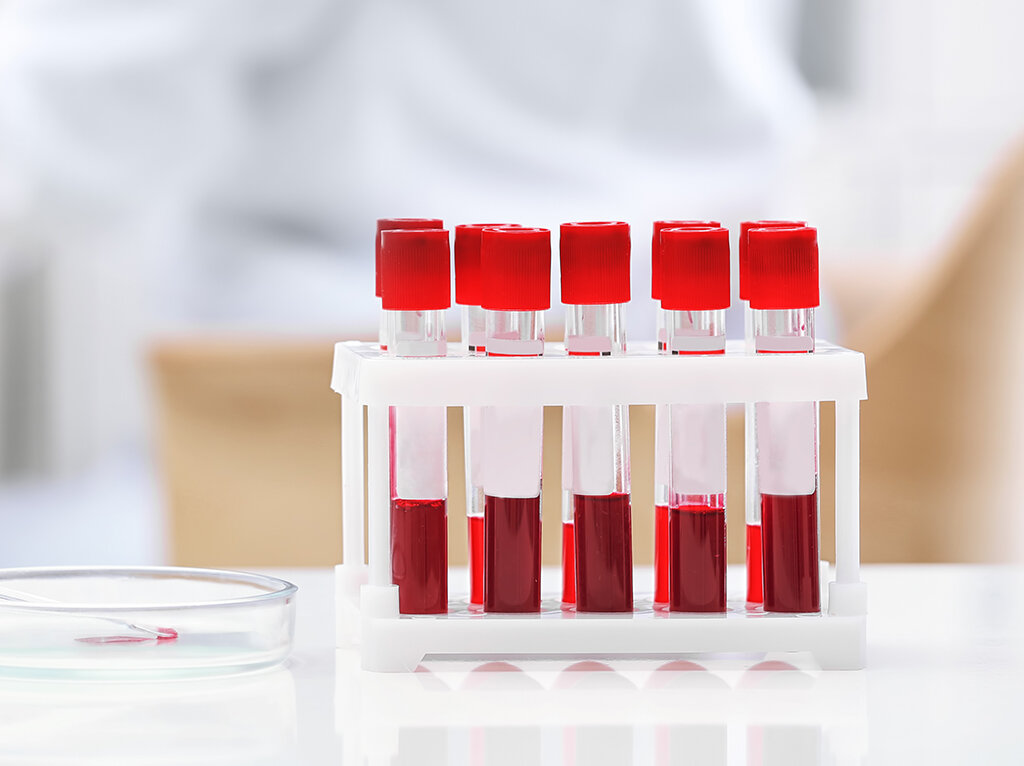 фото взято с источника: http://bashnpvl.ru/