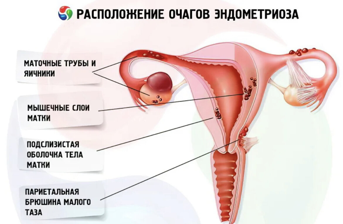 Оболочки матки