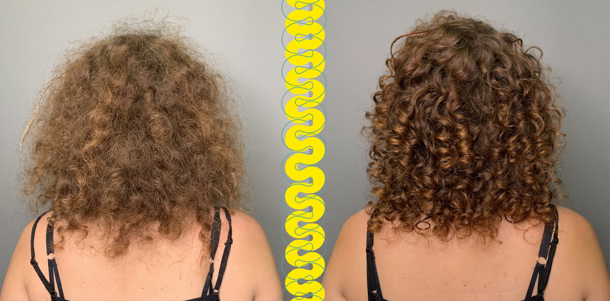 Как остановить сильное выпадение волос у женщин