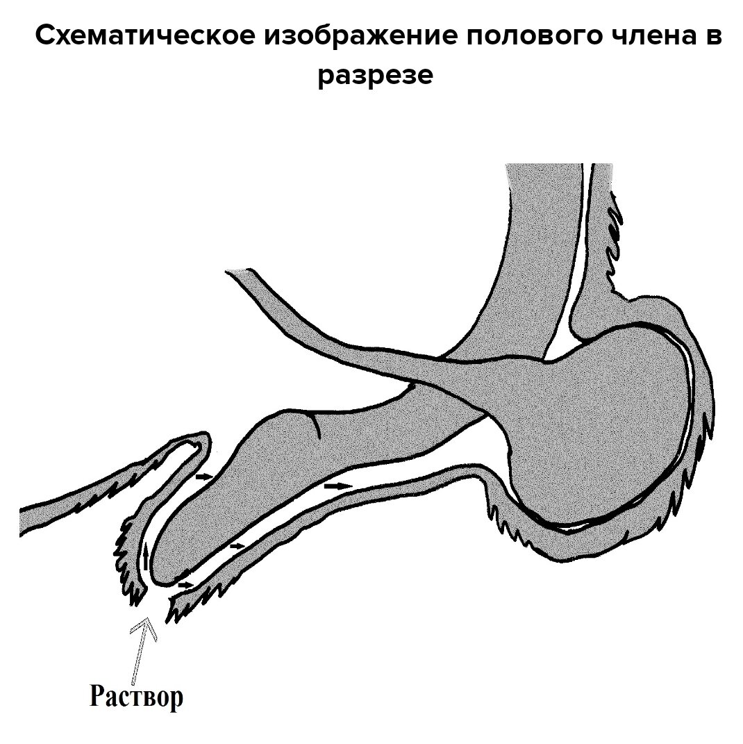 Препуциальный мешок это