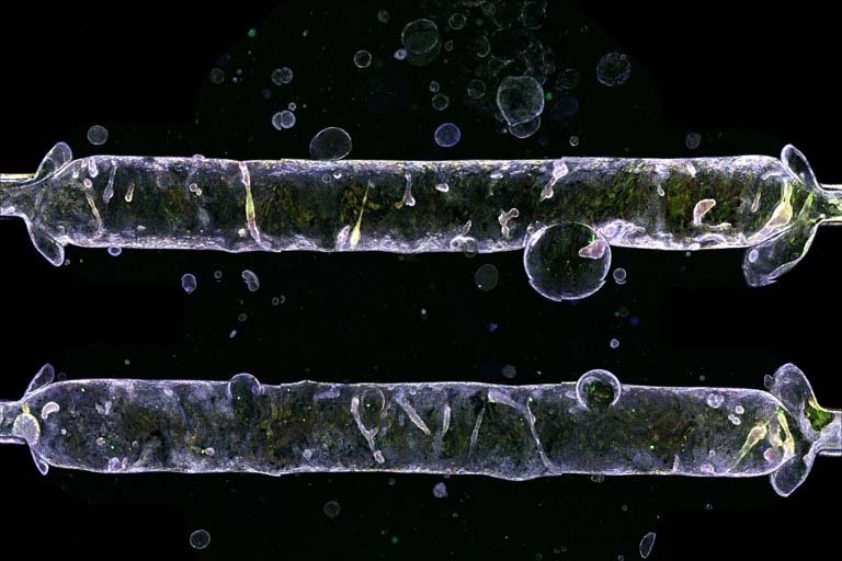 Эти желчные протоки in vitro демонстрируют возможности изучения сложных механизмов гомеостаза (когда все в норме) и при патологии. Кредит Куинтон Смит. Коллекция: Image Awards 2020. Фото отсюда https://ki-galleries.mit.edu/2020/chhabra-1