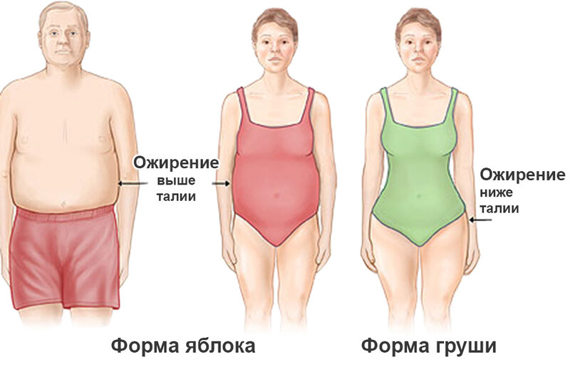 Ожирение по типу "Яблоко" и по типу "Груша". В чем отличия?