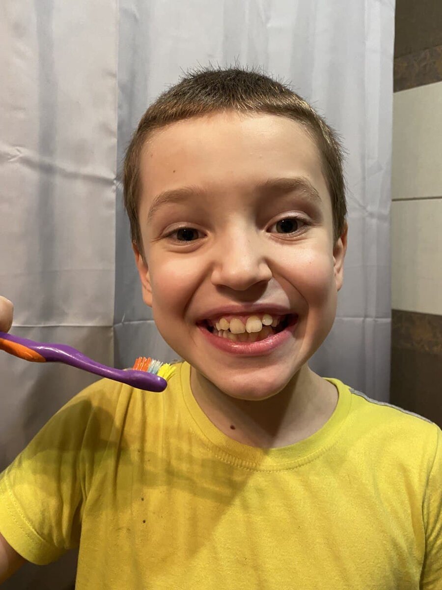 Почему особенным детям важно лечить зубы