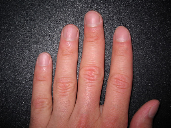 Ногти на руках человека.