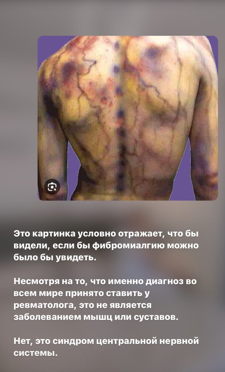 Фото и подпись Виктории Золотовой.