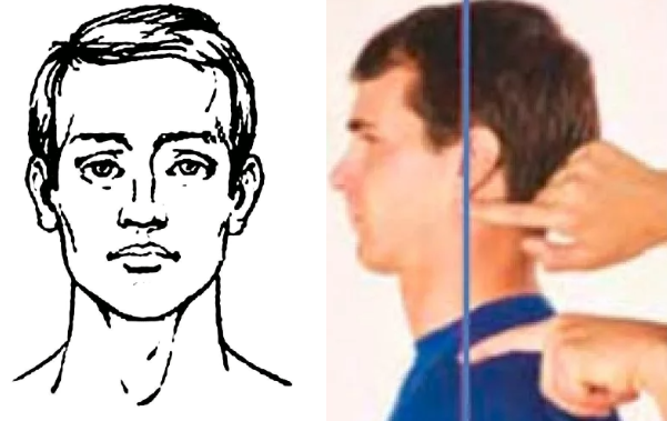 Правильное положение головы - подбородок вниз, затылок чуть назад